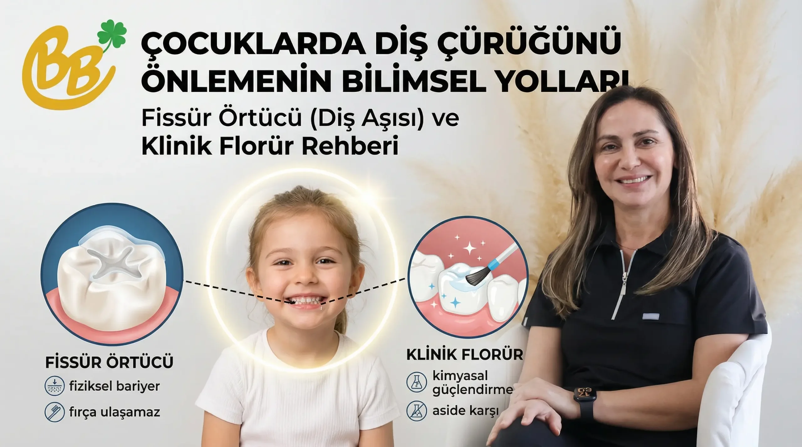 Çocuklarda fissür örtücü (diş aşısı) uygulaması ile diş yüzeyinin korunması - Protecting the tooth surface with fissure sealant (tooth vaccine) application in children - Защита поверхности зуба с применением фиссурного герметика (зубной вакцины) у детей"