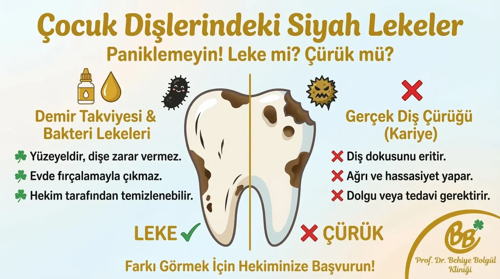 Demir damlaları diş yüzeyinde siyah lekelenmelere yol açabilir ancak bu durum diş yapısına zarar vermez. -